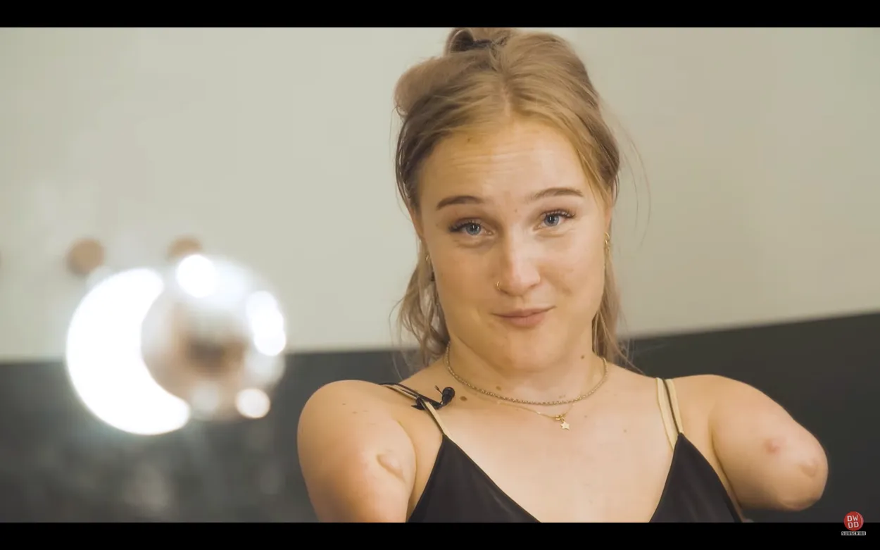 Waarom krijgen mensen met een beperking geen hulp voor make-up? - BNNVARA